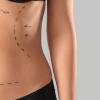 Is Cosmetic Surgery Right for Me?
