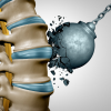 Strong Bones Start with Small Changes